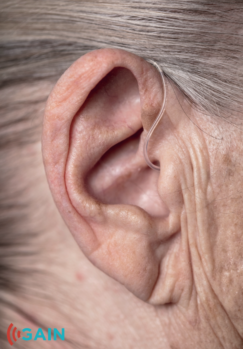 GAIN geeft gehoor GAIN 30 jaar innovatie in de hoorzorg